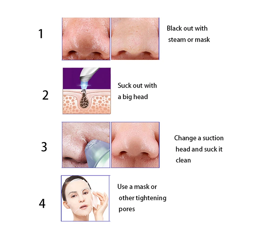 Средство для удаления угрей для ухода за кожей черный точечный вакуумный аппарат для очистки пор аппарат для чистки лица вакуумный всасывающий инструмент для удаления акне