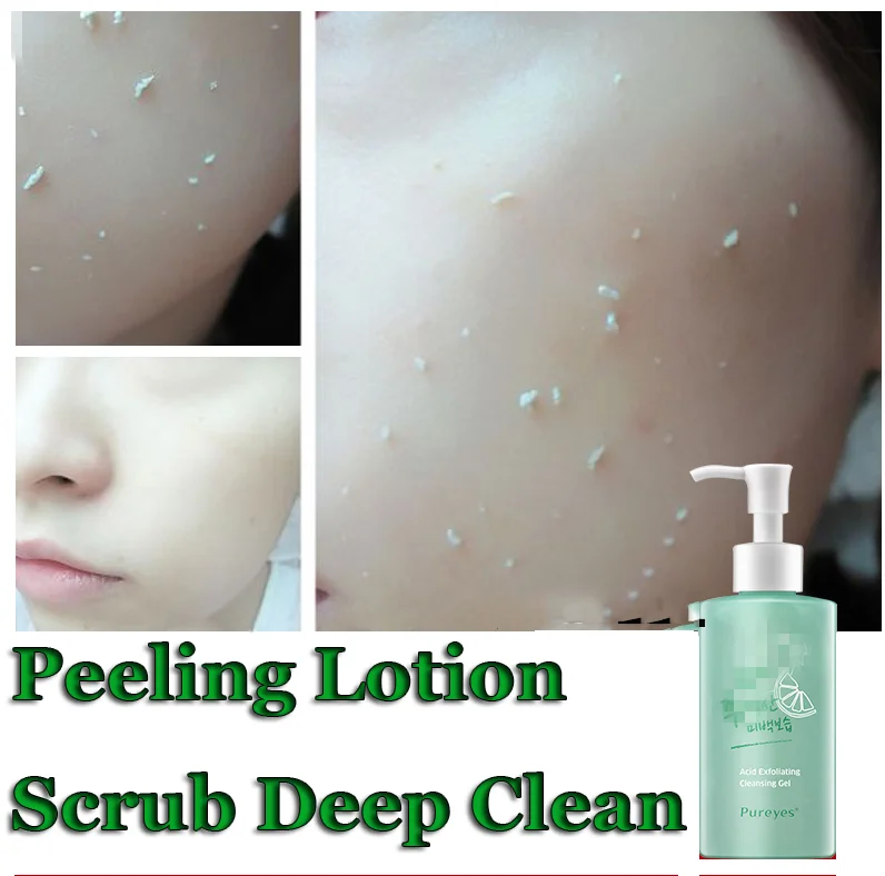 Ecophy Acid Peeling Gel 1ml Facial Cleansing Exfoliating Peeling Scrub Deep Clean Acne Blackhead Remove Face Cleanser Face Cleanser Clean Acnefacial Exfoliator Aliexpress