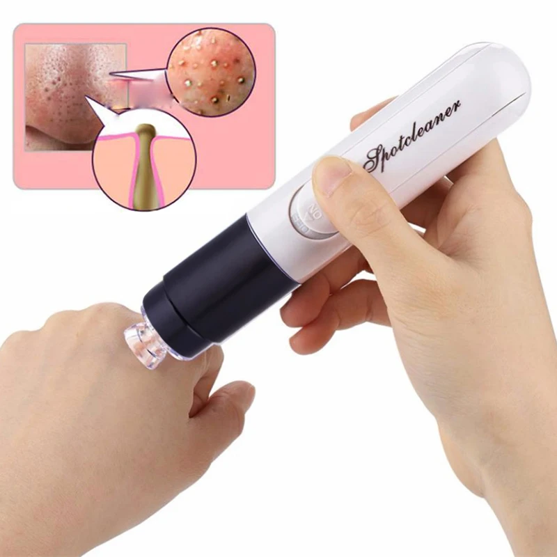 

Electric Blackhead Remover Tool Face Nose Acne Pimple Wart Remover Vacuum Suction Black Spots Pore Cleaner Suck Up Blemish