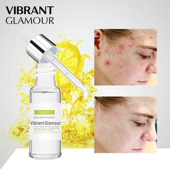 

VIBRANT GLAMOUR Vitamin C Serum Hyaluronic Acid Face Cream Remover Acne Treatment Fade Dark Spots Anti-Aging Whitening Skin care