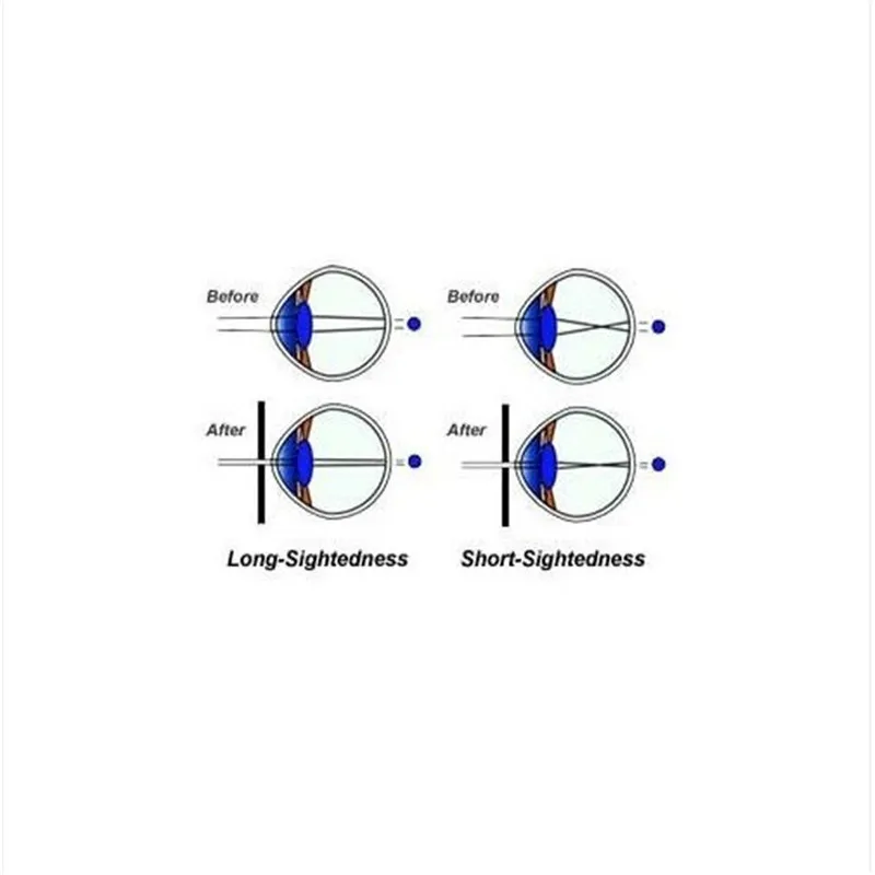 Eyesight Improvement Vision Care Exercise Eyewear Pinhole Glasses (8)
