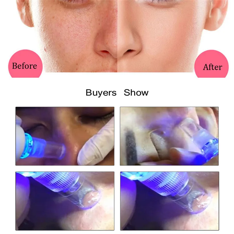 Máquina de Sucção a Vácuo Dispositivo de Massagem Removedor de Pele Morta da Pele Facial Elétrica Utiliza Pore Cleaner Cravo Acne Massagem Limpo 22 Acne Removedor de Pele Morta Da Pele Massagem Limpo