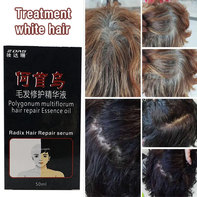 Pure Chinese geneeskunde gebrouwen permanent zwart haar permanent elimineren haar voorkomen haaruitval & Hoofdhuid Behandeling|scalp treatment|hair losshair scalp treatment - AliExpress