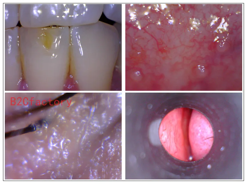 Новый 2MP USB Цифровые микроскопы видео лупа Камера отоскоп Стоматологическая микроскоп