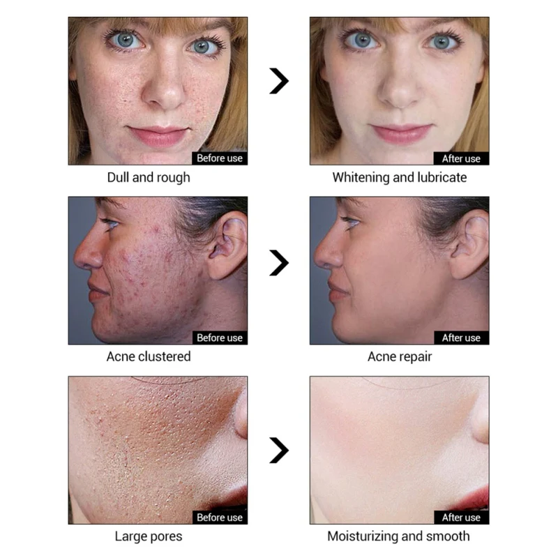 Soro Facial Anti Rugas Anti Envelhecimento Hidratante