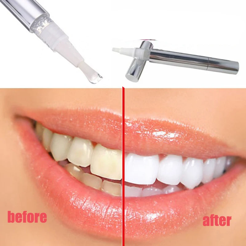 

Popular White Teeth Whitening Pen Tooth Gel Whitener Bleach Remove Stains oral hygiene HOT SALE