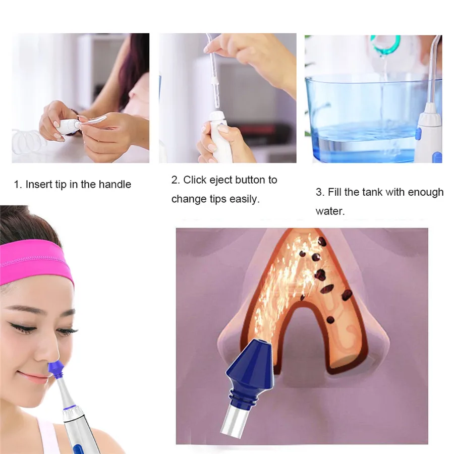 9-Pcs-Monddouche-Water-Flosser-Vervanging-Tips-Nozzles-Tanden-Bleken-Accessoires-Orthodontische-Dental-Plaque-Neus-Wassen (2)