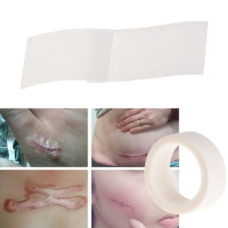 Шрам лечение лист лента ремонт силиконовый гель нанесение полос медицинский многоразовый