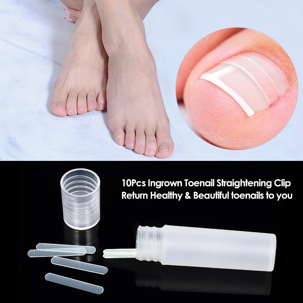 

10Pcs Ingrown Toenail Straightening Clip Curved Sticker Patch Toenail Paronychia Elastic Patches Correction Pedicure Tools
