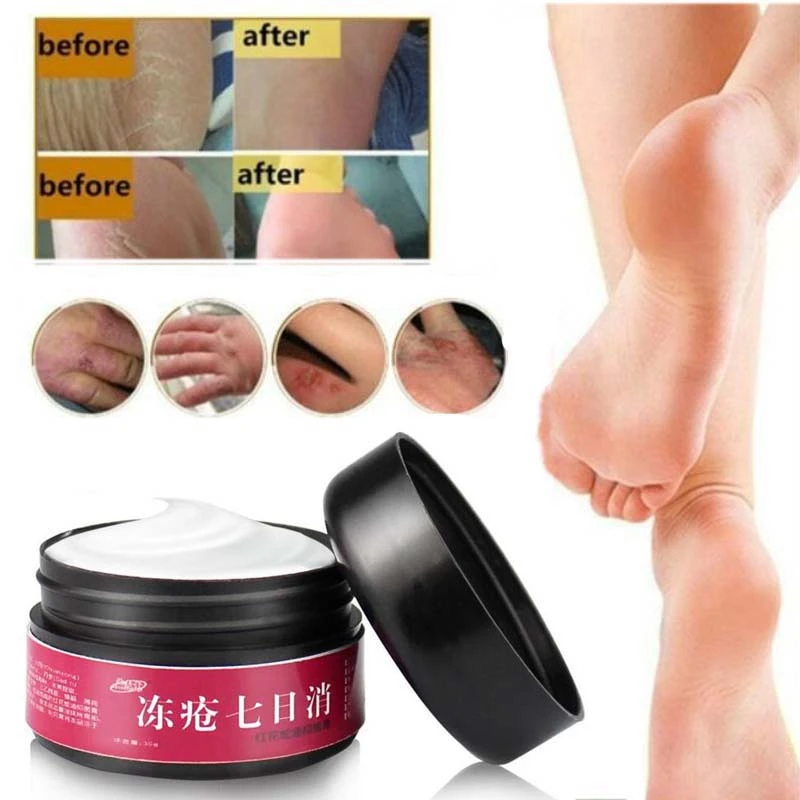

Foot Hand Repair Anti Dry Crack Ointment Cream Skin Repair Moisturizing Cream Foot Crack Cream Heel Chapped Peeling s2