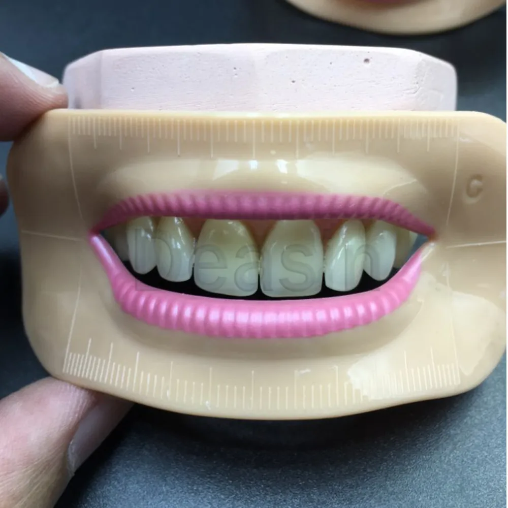 

Dental lab denture laboratory mouth measuring lip measurement tool aesthetics parts 4 pcs different shape