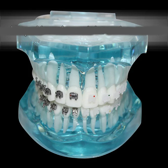 

Dental Orthodontic model self-ligating bracket straight wire edgewise bracket four kinds of ceramic brackets comparison model