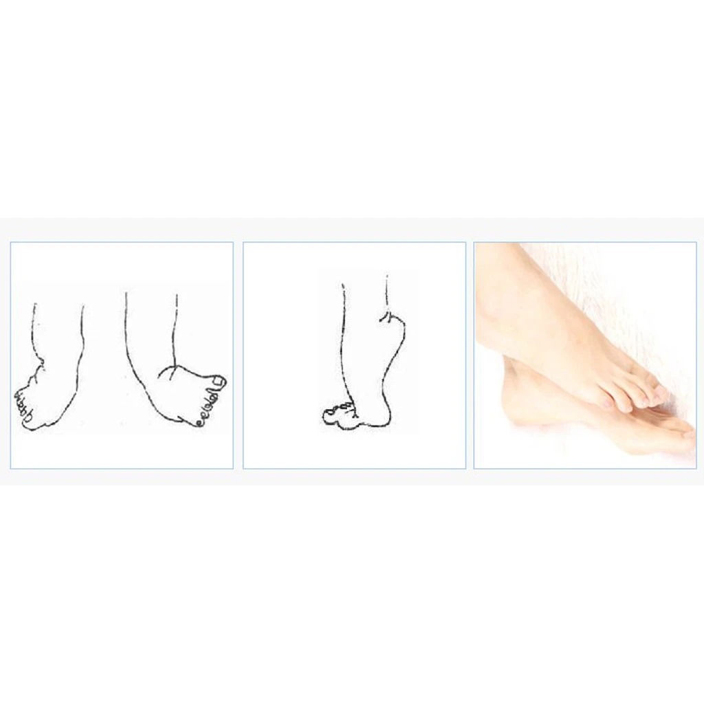 Adjustable Foot Drop Brace Orthosis Correction Ankle Support Stabilizer for Right Foot