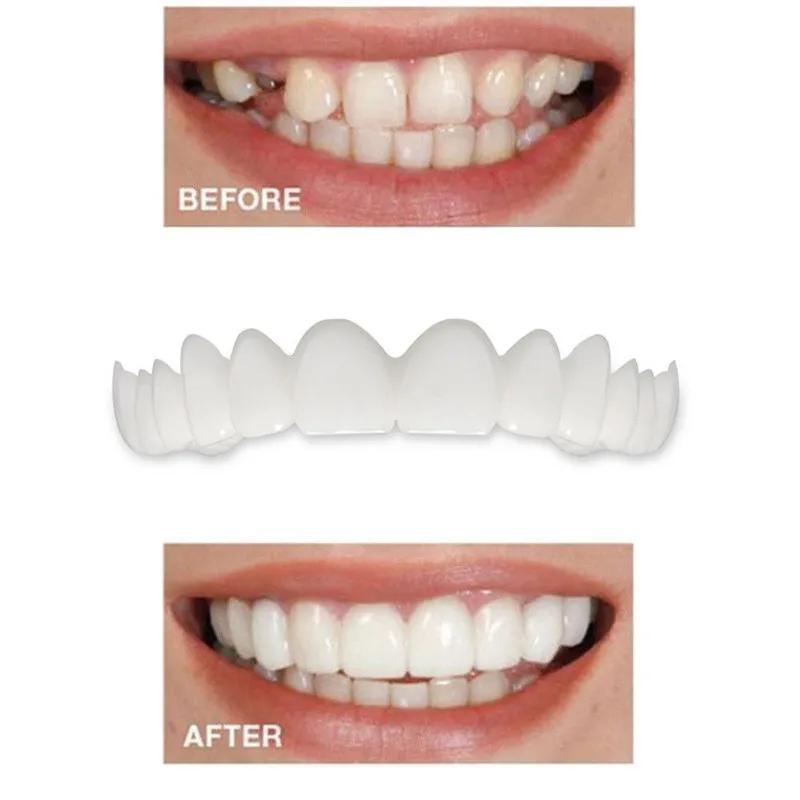 

Tooth Cover 5PC Temporary Smile Comfort Fit Cosmetic Teeth Denture Top Cosmetic Veneer Hot INS Drop <=487g30