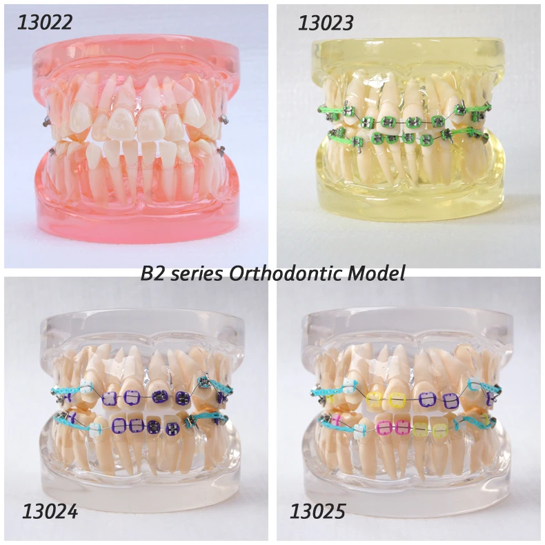 

DH/13022, Transparent Orthodontic Model, 24 tooth, Transparent Gum, Dentist Education Oral Dental Orthodontic Model