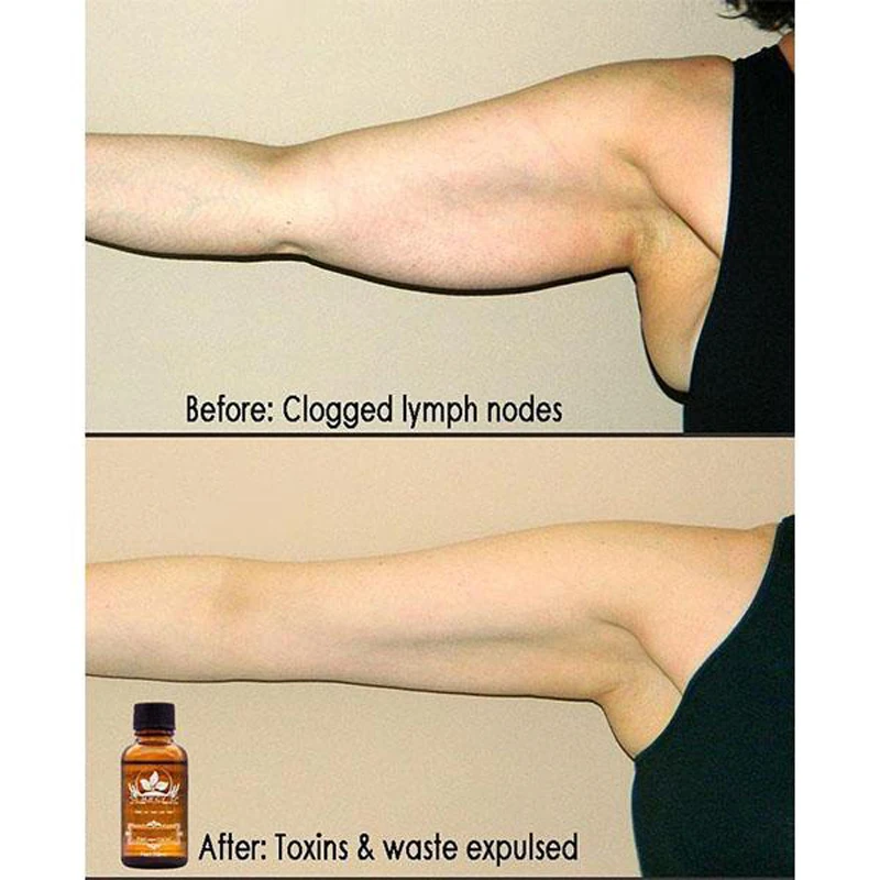 Plant Therapy Lymphatic Drainage Ginger Oil JOOPZY