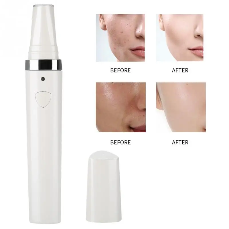 3 IN 1 Acne Removal Pen for Scar Repair Skin Rejuvenation Machine Acne