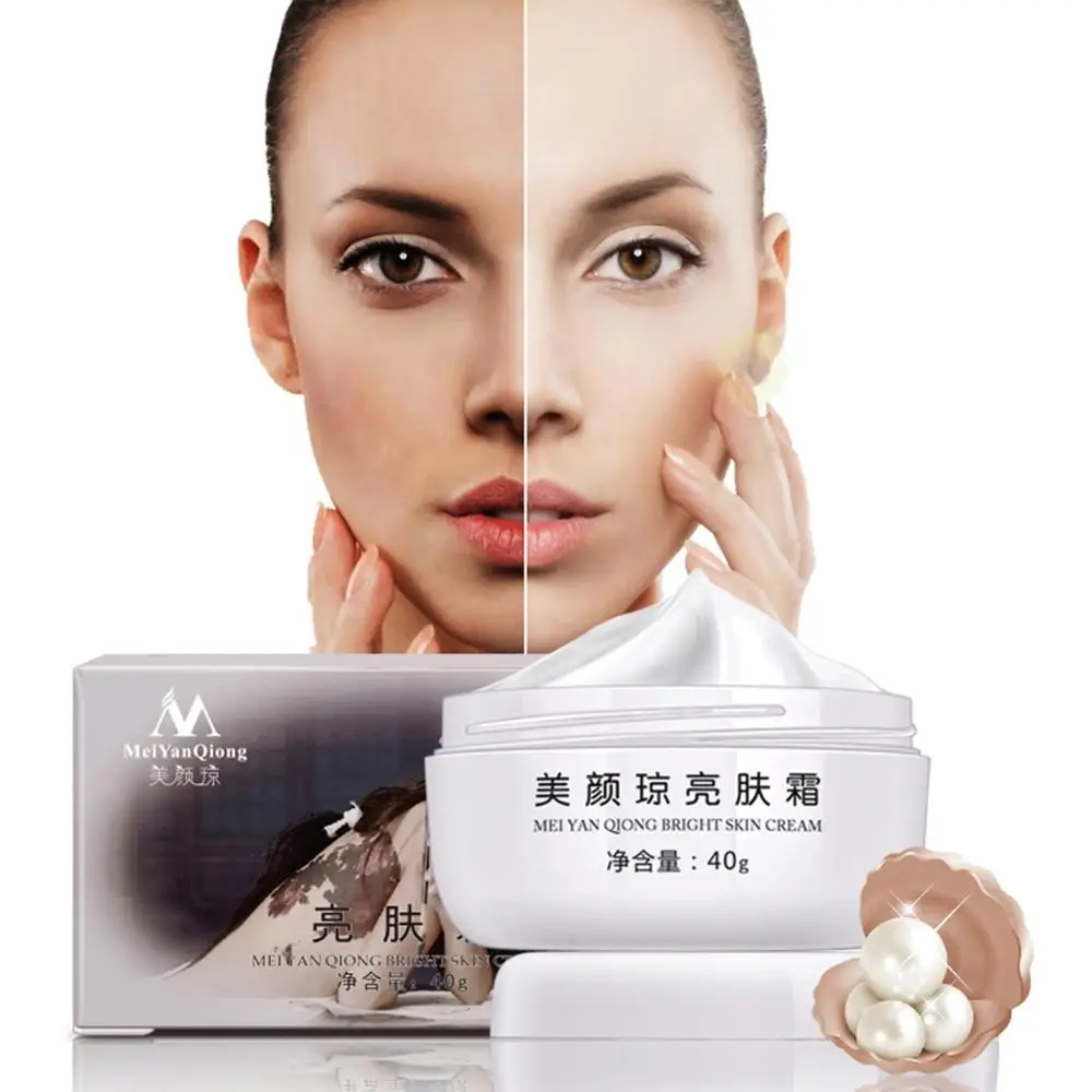 

Strong Effects Powerful Whitening Freckle Cream 40g Remove Melasma Acne Spots Pigment Melanin Dark Spots Face Care Cream skin
