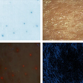 

Professional Suyzeko skin analyzer aumotatic skin analysis test machine