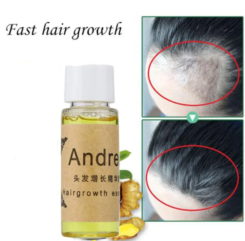 Andrea Hair Growth Жидкость против выпадения волос 20 мл натуральный экстракт с натуральным восстанавливанием волос быстро, гуще, Andrea Hair Growth Oi