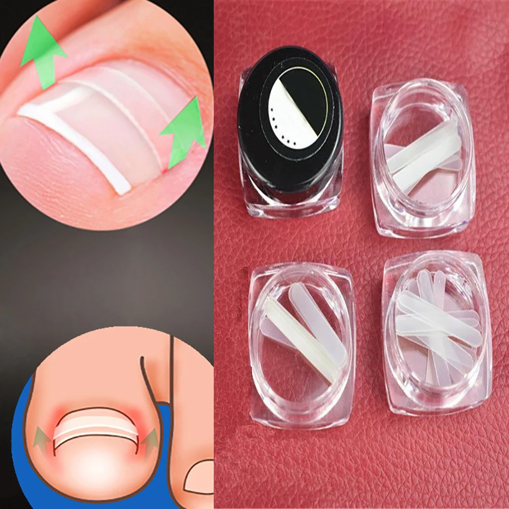 GUJHUI 10Pcs/Box Ingrown Toe Nail Correction Sticker Paronychia Foot Care Treatment