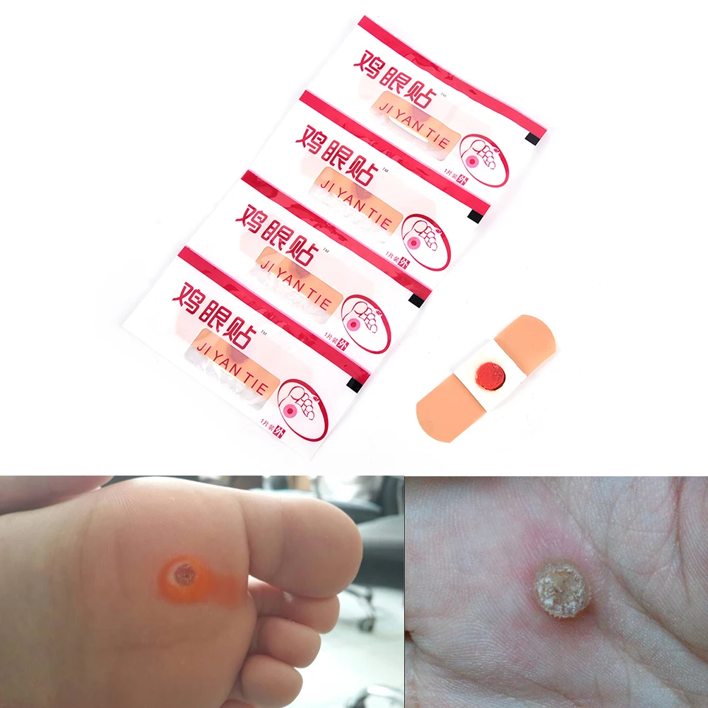 

10pcs chinese traditional remove hand corn dead skin pedicure medical hand foot corn cocoon sticker