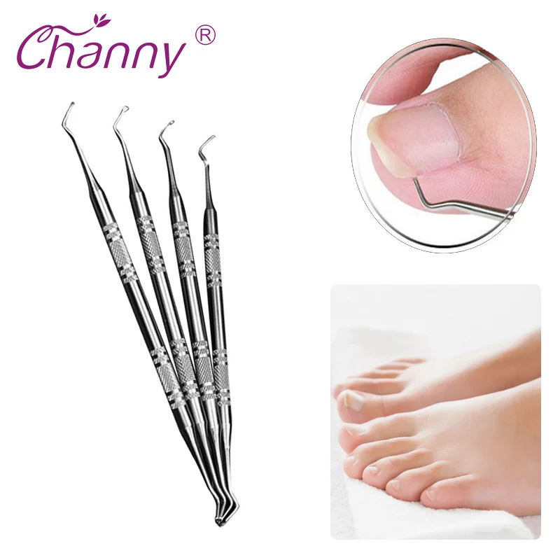 

Channy Ingrown Toe Nail Correction Lifter File Clean Installation Tool Pedicure Foot Nail Care Hook Ingrown Toenails Dropship