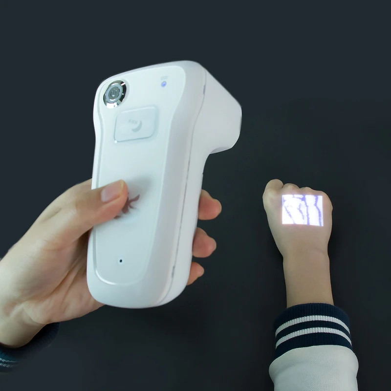 vein finder-5