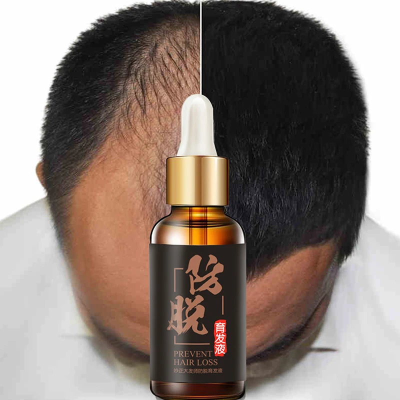 

100% Hair Loss Liquid Hair Growth Essential Oils Essence Original Authentic Health Care Dense Hair Growth Serum