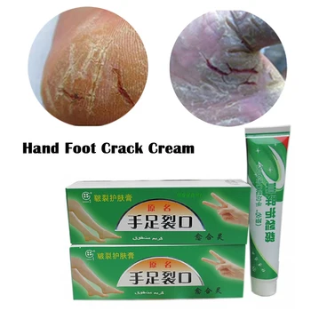 

Hand Foot Crack Cream Heel Chapped Peeling Feet and Hands Repair Anti Dry Crack Skin Chinese Medicinal Ointment Skin Care