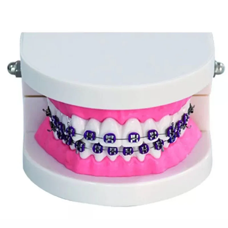 

28Pcs Teeth Metal Brcker Orthodontics Dental Models for Teaching