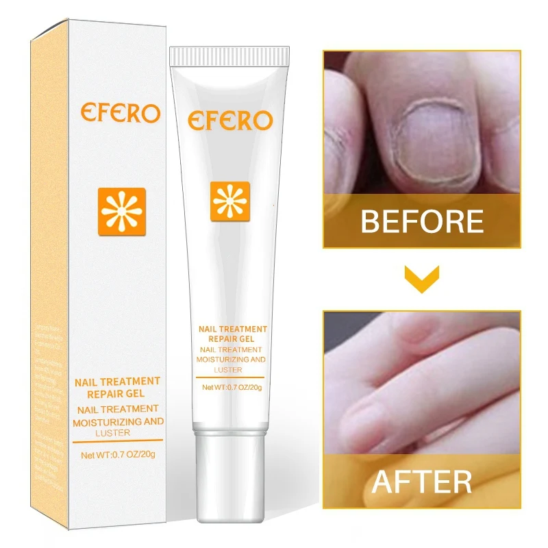 20g Nail Care Tools Anti Toenail Fungus Nails Nourishing Cream Nail Treatment Hand Foot Protector Nails Repair Serum