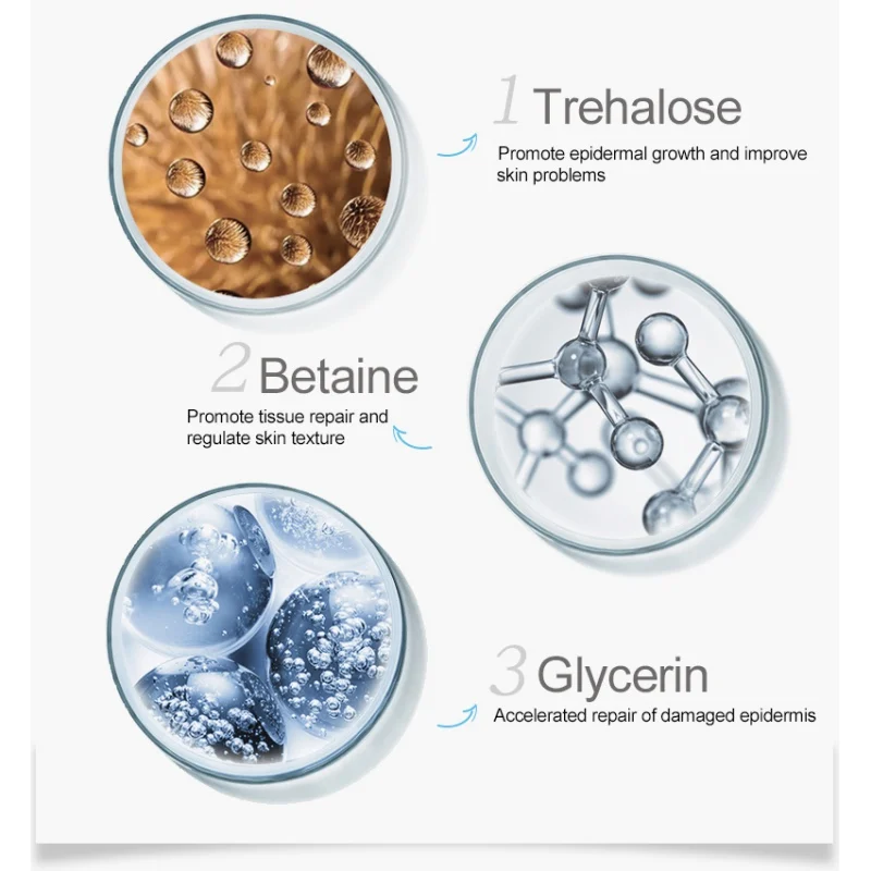 Nicotinamide увлажняющая эссенция анти-акне гладкие тонкие линии антивозрастная Сыворотка для лица для улучшения проблем кожи