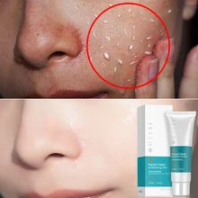 Deep Cleansing Exfoliating Peeling Gel Moisturizes Face Exfoliating Cream Soft Organic Facial Cream Facial Scrub Cleaner TSLM1