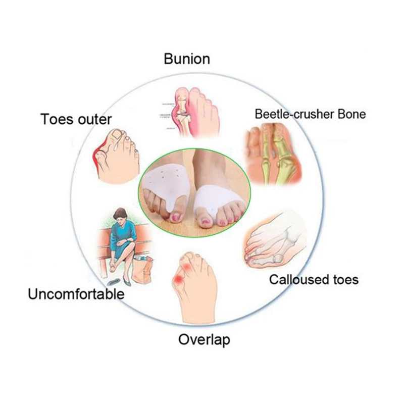 1 пара медицинский силиконовый гель для ног пальцы ног разделитель косточка на большом пальце профилактика бурсита Настройщик профилактика «косточек» на ноге Уход за ногами