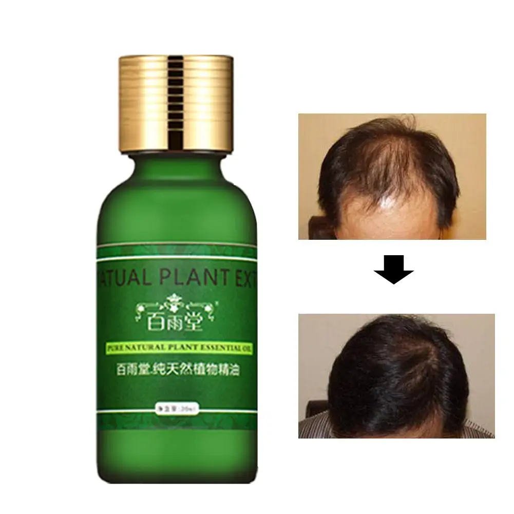 

Unisex Moisturizing Repairing Hair Growth Essential Oil Anti Loss Health Care