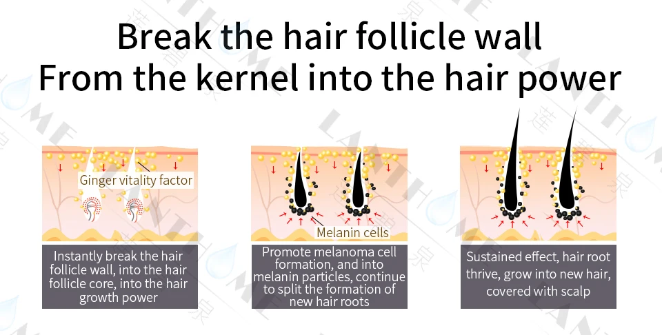 Sunburst спрей для роста волос продукты имбирный шампунь для роста волос для женщин и мужчин Кератиновый Уход за волосами против облысения лечение падения волос