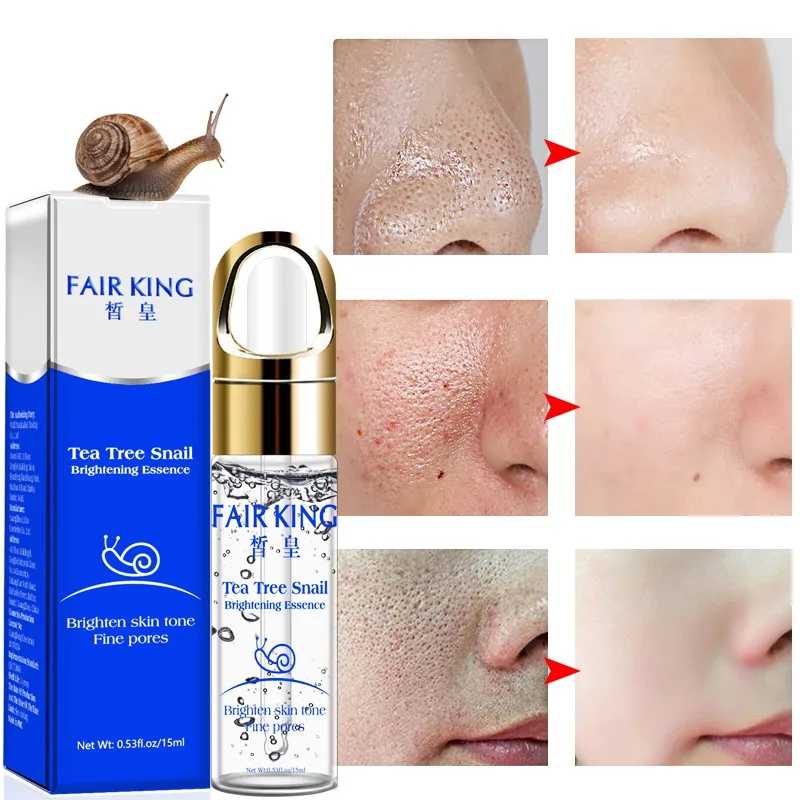 DropShipping 15ml Tea Tree Snail Brightening Essence Oil Liquid Brighten skin tone Fine pores ingredients Z1229 | Красота и здоровье