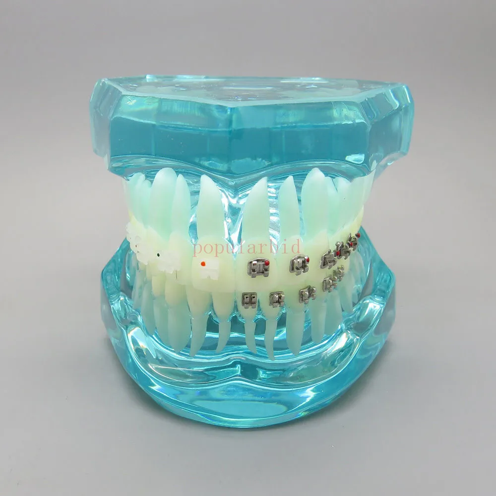 

Dental Orthodontics Model With 4 Types of Brackets teaching model patient communication model