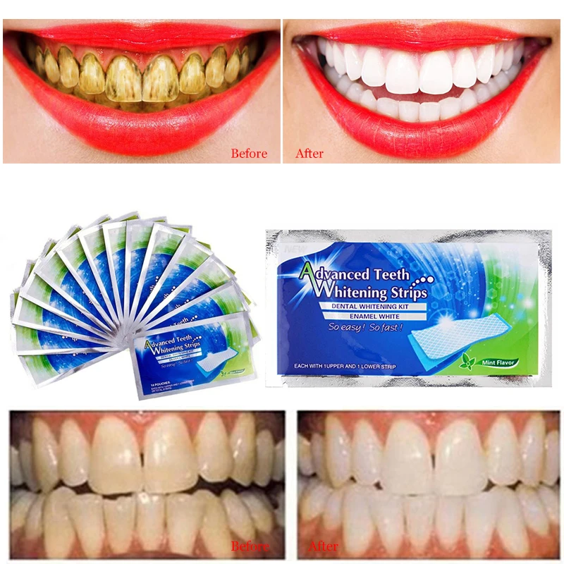 New 2pcs/bag Dental Teeth Whitening Strips Tooth Whitening Strip Tooth