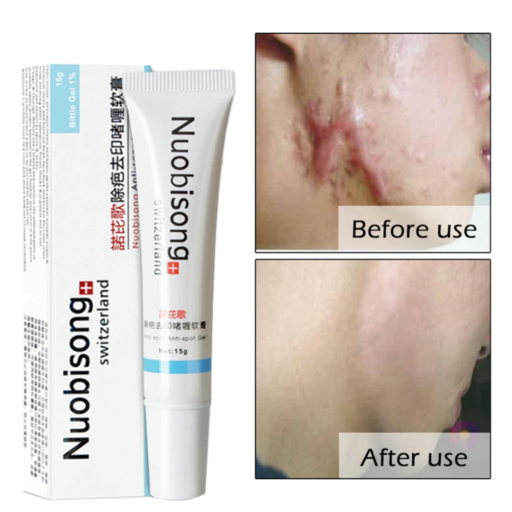 night cream to remove acne scars