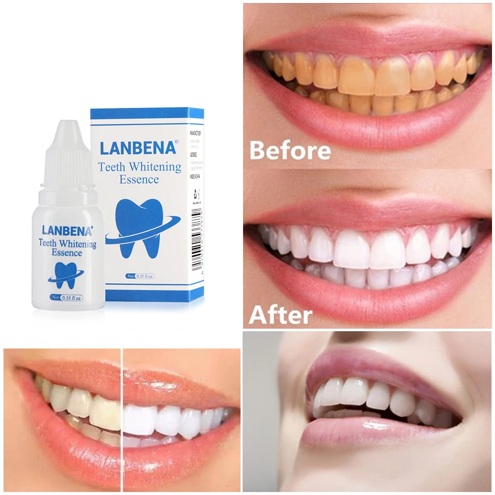 10ml Liquid Tooth Whitening Essence Serum Removes Oral Hygiene Cleaning
