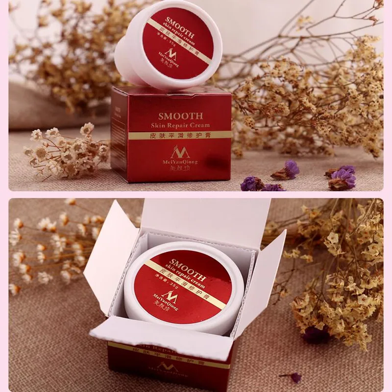 Bodys estraza marcas eliminación de cicatrices crema manteca de karité Anti acné reafirmante Creme para maternidad embarazo postparto Stria piel suave
