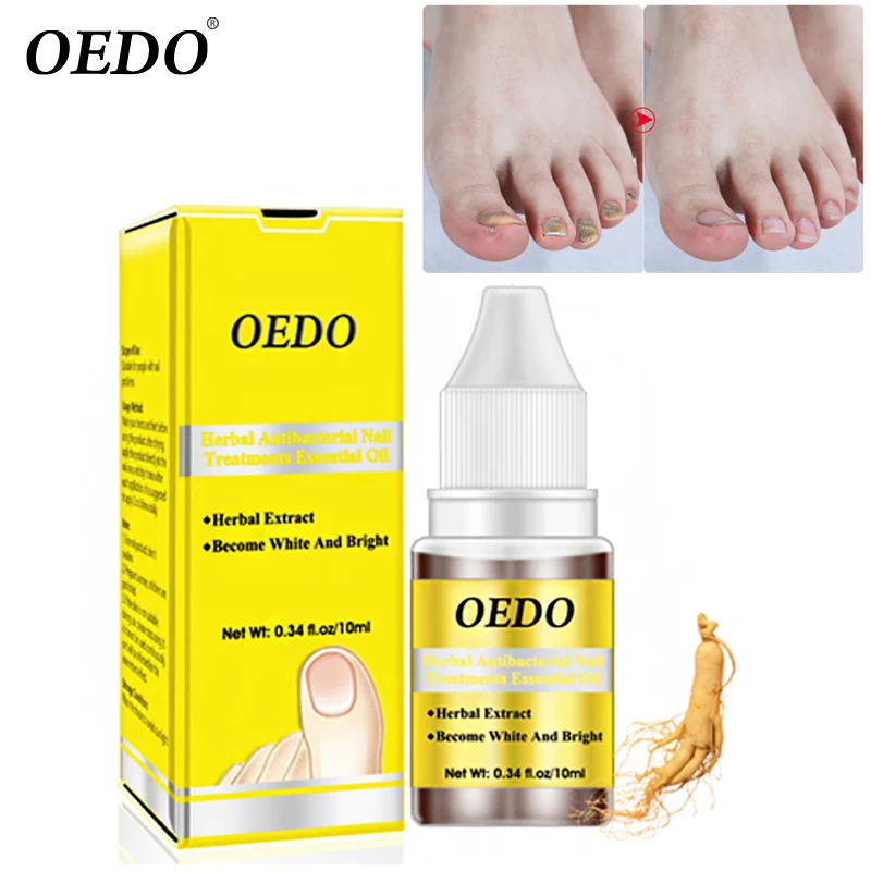 Ginseng Antibacterial Nail Treatments Essential Oil Nails Fungus Repair Foot Nail Care SK88