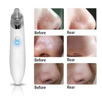 

Electric Mini Handheld Dead Skin Acne Vacuum Suction Blackhead Remover Face Lifting Skin Tightening Rejuvenation Beauty Machine