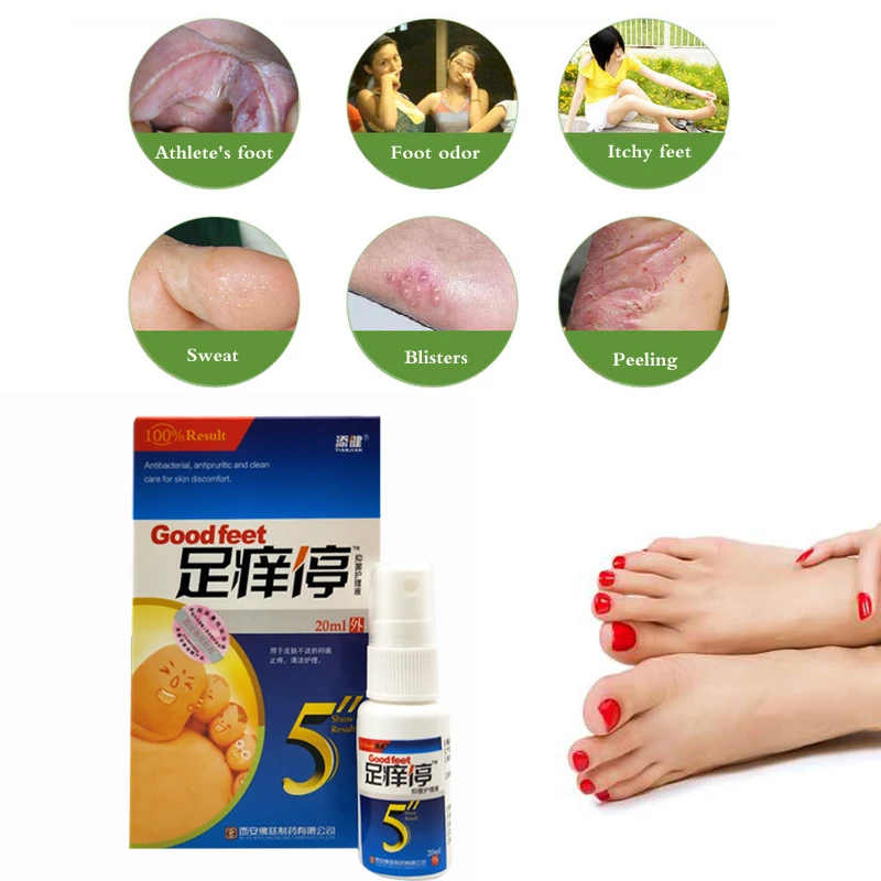 Foot and shoe Deodorant Bacteriostatic spray Remove athlete's foot and