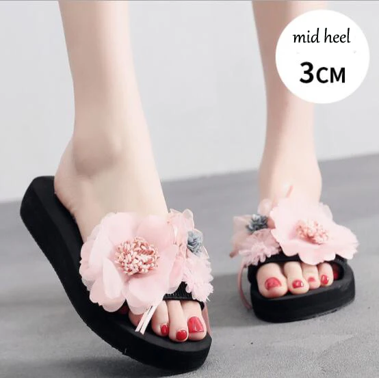 3CM