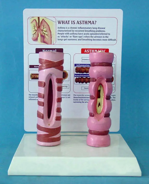 

human Tracheal anatomy model Sick trachea Medical Teaching free shipping