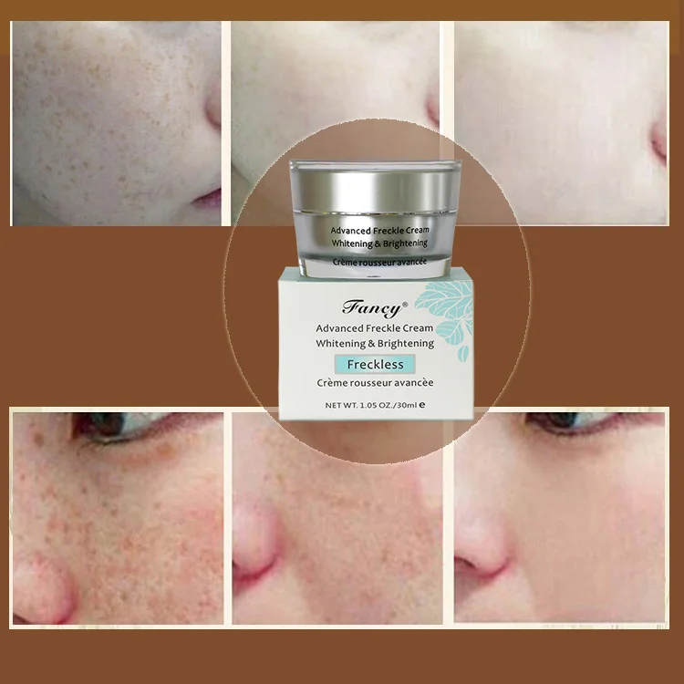 clear skin lightening cream