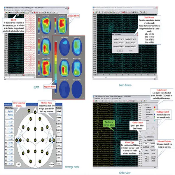 KT88-1016 16-канальный Портативный цифровой ЭЭГ мозг отображения Scanne